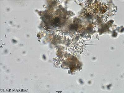 phyto/Bizerte/bizerte_bay/RISCO February 2015/Trieres mobiliensis (ancien Baie_T1-B_Odontella-3).tif(copy)_thumb.jpg